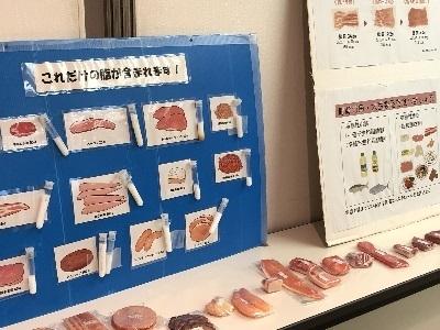 コレステロール・中性脂肪の展示